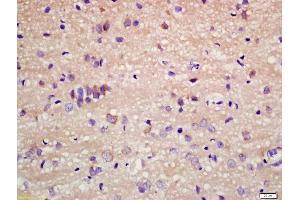 Formalin-fixed and paraffin embedded rat brain labeled with Anti-Staufen Polyclonal Antibody, Unconjugated (ABIN1385730) at 1:200 followed by conjugation to the secondary antibody and DAB staining (STAU1/Staufen antibody)