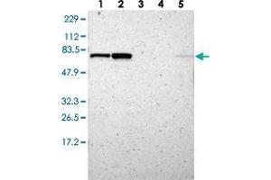 Western blot analysis of Lane 1: RT-4, Lane 2: U-251 MG, Lane 3: Human Plasma, Lane 4: Liver, Lane 5: Tonsil with RNGTT polyclonal antibody .