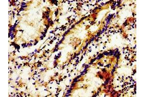 Immunohistochemistry of paraffin-embedded human appendix tissue using ABIN7158134 at dilution of 1:100 (LGR6 antibody  (AA 839-962))
