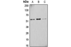 Western blot analysis of Cytochrome P450 2D6 expression in A431 (A), K562 (B), HuvEc (C) whole cell lysates. (CYP2D6 antibody  (N-Term))