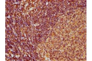 IHC image of ABIN7145992 diluted at 1:100 and staining in paraffin-embedded human lymph node tissue performed on a Leica BondTM system. (CCL27 antibody  (AA 25-112))