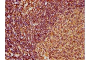 IHC image of ABIN7145992 diluted at 1:100 and staining in paraffin-embedded human lymph node tissue performed on a Leica BondTM system.