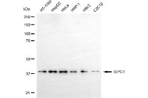 Western blotting analysis using GIPC1 antibody (ABIN7798720).