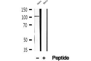 Western blot analysis of extracts of HeLa cells, using KIF18A antibody. (KIF18A antibody  (Internal Region))