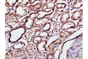 Paraformaldehyde-fixed, paraffin embedded human kidney tissue, Antigen retrieval by boiling in sodium citrate buffer(pH6) for 15min, Block endogenous peroxidase by 3% hydrogen peroxide for 30 minutes, Blocking buffer (normal goat serum) at 37°C for 20min, Antibody incubation with Rabbit Anti-PKR(Thr451) Polyclonal Antibody, Unconjugated  at 1:500 overnight at 4°C, followed by a conjugated secondary and DAB staining (EIF2AK2 antibody  (pThr451))