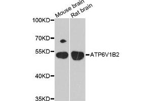 Western blot analysis of extracts of mouse brain and rat brain cell lines, using ATP6V1B2 antibody. (ATP6V1B2 antibody)