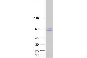 CCDC130 Protein (Myc-DYKDDDDK Tag)