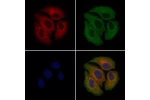 ABIN7093126 and ABIN7098645 staining Hela cells by IF/ICC. (Factor VII antibody  (Internal Region))
