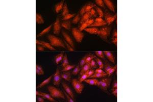 Immunofluorescence analysis of H9C2 cells using EXOSC2 Rabbit pAb (ABIN6127886, ABIN6140374, ABIN6140375 and ABIN6214708) at dilution of 1:100. (EXOSC2 antibody  (AA 1-293))