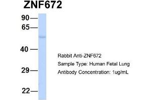 Host:  Rabbit  Target Name:  ZNF672  Sample Type:  Human Fetal Lung  Antibody Dilution:  1. (ZNF672 antibody  (Middle Region))