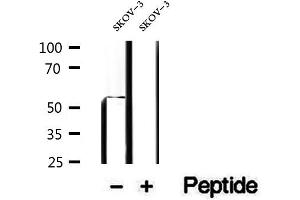 Western blot analysis of extracts of SKOV-3 cells, using PDHX antibody. (PDHX antibody)