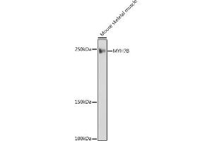 Western blot analysis of extracts of Mouse skeletal muscle, using MYH7B antibody (ABIN7268759) at 1:1000 dilution. (MYH7B antibody)