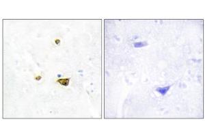 Immunohistochemistry analysis of paraffin-embedded human brain tissue, using EZH1 antibody. (EZH1 antibody  (Internal Region))