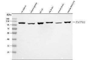 Western blot analysis of CD39/Entpd1 using anti-CD39/Entpd1 antibody (ABIN7601581).