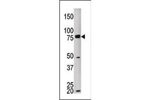 The anti-MELK Pab (ABIN391224 and ABIN2841298) is used in Western blot to detect MKEL in HEPG2 tissue lysate (MELK antibody  (C-Term))