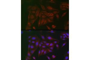 Immunofluorescence (IF) image for anti-Interleukin 6 Signal Transducer (Gp130, Oncostatin M Receptor) (IL6ST) (AA 678-857) antibody (ABIN7268003)
