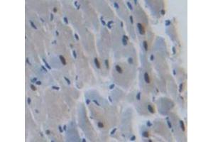 Figure. (ANKRD1 antibody  (AA 5-279))