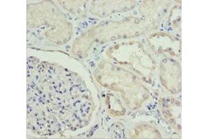 Immunohistochemistry of paraffin-embedded human kidney tissue using ABIN7151499 at dilution of 1:100 (ETFA antibody  (AA 1-333))
