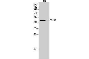 Western Blotting (WB) image for anti-Poliovirus Receptor (PVR) (Internal Region) antibody (ABIN3178974) (Poliovirus Receptor antibody  (Internal Region))