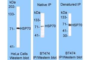Image no. 1 for anti-Heat Shock Protein 70 (HSP70) antibody (ABIN187606) (HSP70 antibody)