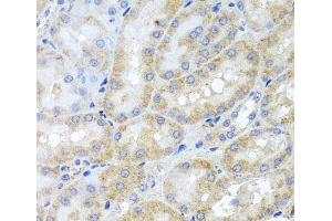 Immunohistochemistry of paraffin-embedded Rat kidney using PEX3 Polyclonal Antibody at dilution of 1:100 (40x lens).