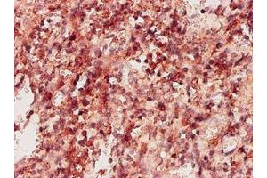Image no. 1 for anti-Ketohexokinase (KHK) (AA 1-299) antibody (ABIN598769) (Ketohexokinase antibody  (AA 1-299))