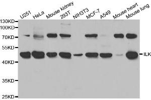 Western blot analysis of extracts of various cell lines, using ILK antibody (ABIN5970329) at 1/1000 dilution. (ILK antibody)