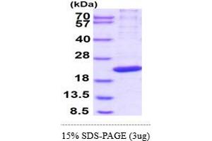 SDS-PAGE (SDS) image for Polymerase (RNA) II (DNA Directed) Polypeptide H (POLR2H) (AA 1-150) protein (His tag) (ABIN5852947)