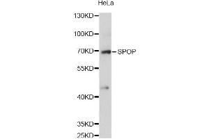 Western blot analysis of extracts of HeLa cells, using SPOP antibody (ABIN6292286) at 1:3000 dilution. (SPOP-B antibody)