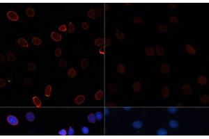 Immunofluorescence analysis of C6 cells using Acetyl-Histone H3-K56 Polyclonal Antibody at dilution of 1:100. (Histone 3 antibody  (acLys56))