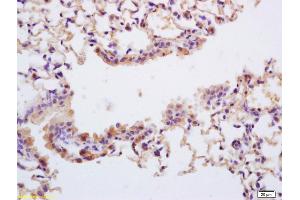 Formalin-fixed and paraffin embedded mouse lung labeled with Rabbit Anti Phospho-TrkA (Tyr490) /TrkB (Tyr516) Polyclonal Antibody, Unconjugated (ABIN746603) at 1:200 followed by conjugation to the secondary antibody and DAB staining (TRKA antibody  (pTyr496))