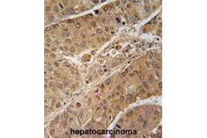 Immunohistochemistry (IHC) image for anti-Ribosomal Protein S6 Kinase, 70kDa, Polypeptide 2 (RPS6KB2) antibody (ABIN2909954) (RPS6KB2 antibody)