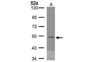WB Image Sample(30 ug whole cell lysate) A:MOLT4 , 10% SDS PAGE antibody diluted at 1:3000