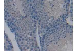Immunohistochemistry (IHC) image for anti-Caspase 9, Apoptosis-Related Cysteine Peptidase (CASP9) (AA 1-200) antibody (ABIN7432247)