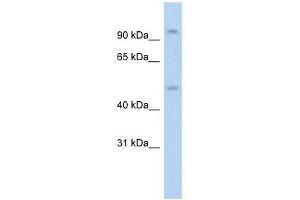 Western Blot showing NR3C1 antibody used at a concentration of 1. (Glucocorticoid Receptor antibody  (N-Term))