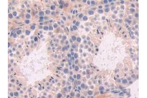 Detection of XDH in Mouse Testis Tissue using Polyclonal Antibody to Xanthine Dehydrogenase (XDH)