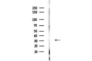 anti-NBPF1,9,10,12,14,15,16,20 (C-Term) antibody