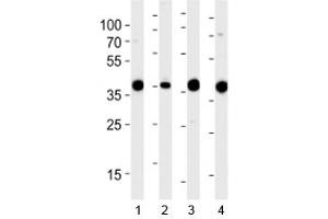 Western blot analysis of lysate from 1) 293, 2) RD, 3) mouse NIH3T3 and 4) rat L6 cell line using Aldolase antibody at 1:1000. (ALDOA antibody  (AA 66-95))