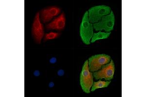 ABIN6265683 and ABIN6278367 staining Hela cells by IF/ICC. (TPBG antibody  (C-Term))
