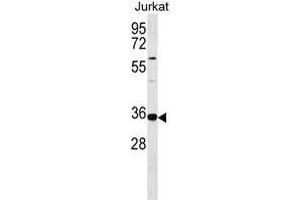 TRNAU1 Antibody (Center) 18294c western blot analysis in Jurkat cell line lysates (35 μg/lane). (TRNAU1AP antibody  (AA 160-186))