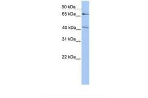 Image no. 1 for anti-Carbohydrate (Chondroitin 4) Sulfotransferase 13 (CHST13) (AA 38-87) antibody (ABIN6739242) (CHST13 antibody  (AA 38-87))
