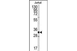 Western blot analysis of anti-CDK2 Antibody (C-term) (ABIN391746 and ABIN2841622) in Jurkat cell line lysates (35 μg/lane). (CDK2 antibody  (C-Term))