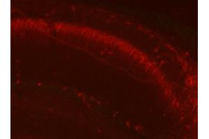 KC rabbit anti- Kv2. (GFAP antibody  (AA 411-422))