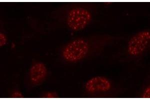 Immunofluorescence analysis of methanol-fixed HeLa cells using Phospho-MAPKAPK2(T334) Polyclonal Antibody (MAPKAP Kinase 2 antibody  (pThr334))