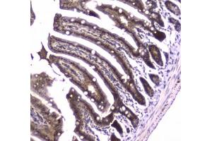 IHC testing of FFPE mouse small intestine tissue with Glutathione Reductase antibody at 1ug/ml. (Glutathione Reductase antibody)