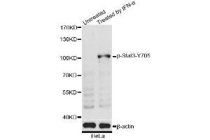 Western blot analysis of extracts of HeLa cells, using Phospho-Stat3-Y705 antibody (ABIN5969916) at 1/2000 dilution. (STAT3 antibody  (pTyr705))