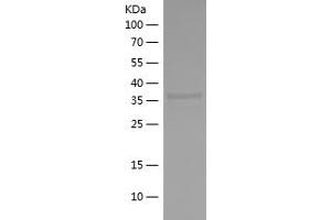 Western Blotting (WB) image for Advanced Glycosylation End Product-Specific Receptor (AGER) (AA 362-404) protein (His-IF2DI Tag) (ABIN7121752)