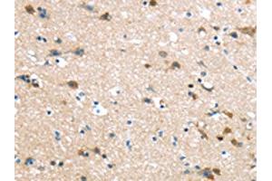 The image on the left is immunohistochemistry of paraffin-embedded Human brain tissue using ABIN7190906(HAUS7 Antibody) at dilution 1/30, on the right is treated with synthetic peptide. (HAUS7 antibody)