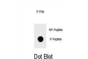 Dot blot analysis of Phospho-IKKB- Antibody Phospho-specific Pab (ABIN1539709 and ABIN2839874) on nitrocellulose membrane. (IKBKB antibody  (pSer675))