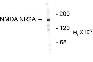 Western blots of 10 ug of rat hippocampal lysate showing specific immunolabeling of the ~180k NR2A subunit of the NMDA receptor.